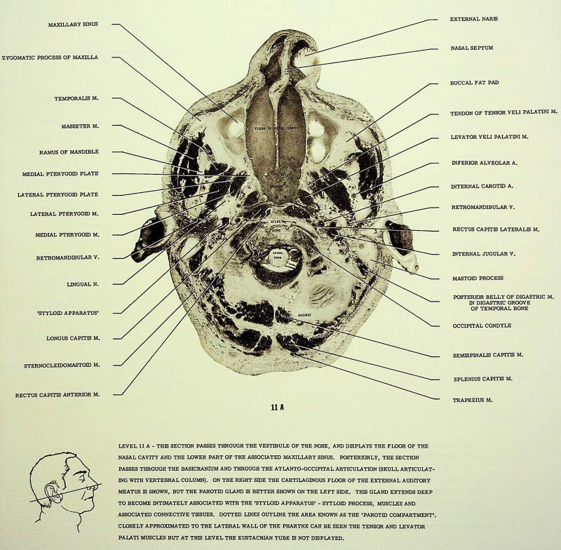 Anatomy of the Head & Neck (cross-sectional views)